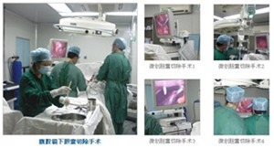 不同类型胆结石 选择适合疗法(图1)