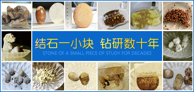 成都用保胆取石术治疗胆结石哪家医院好？(图3)